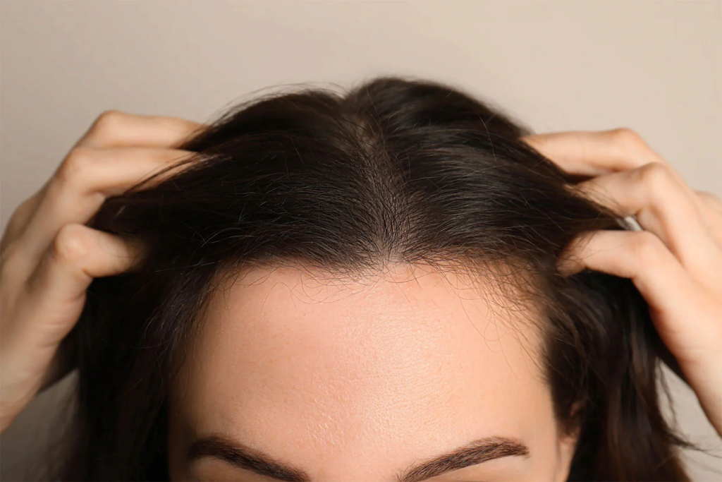 CBD oil Affect Hair Loss And Growth